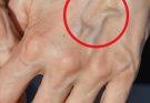 If you have visible veins it means you are…See more