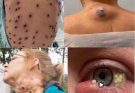 These are the signs that it’s gro…See more