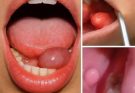 These are the first symptoms of a…See more