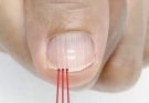 If you have these lines on your nails it’s a clear sign…See more