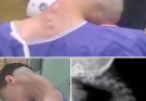 Young man hospitalized because he dropped his ca…See more