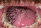 These are the consequences of sleeping with…See more