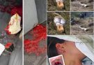 😠R.I.P ðŸ˜Young woman dies at the hands of her…See more