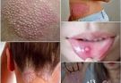 Signs of human papillomavirus that you should know and eat carefully…See more