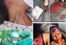 R.I.P ðŸ˜ðŸ˜ðŸ˜ Young woman dies at the hands of her…See more