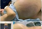 She went into labor, and you won’t believe what they took out of her wo…See more