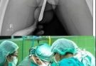 Doctors never talks about this The Penis of old men are…See more