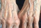 If you have visible veins it means you are…See more