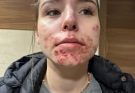 These are the consequences of sleeping with a…See more