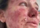 😮Her body was itchy, he thought it was an allergy, they diagnosed him with ca…See more