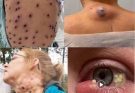 These are the signs that it’s gro…See more