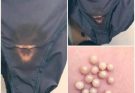 BE CAREFUL, if you notice this in your underwear, it means you have Ca…See more