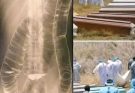 Worldwide alert to the vaccinated…See more